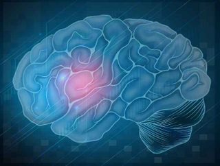 Illustration for article titled Obat Stroke Kiri